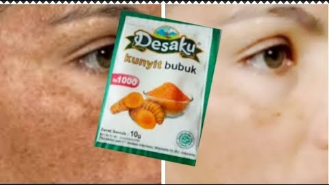 Begini Cara Bikin Wajah Kusam Jadi Glowing dengan Masker Kunyit, Cuma 3 Langkah Bikin Mulus Bebas Noda