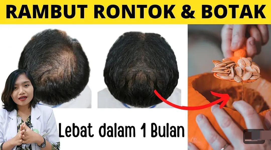 3 Cara Numbuhin Rambut Dengan Bahan Dapur, Ampuh Atasi Kebotakan dan Rambut Uban Dengan Cepat