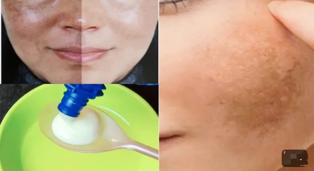 3 Bahan Alami Pengelupas Noda Hitam di Wajah, Cuma 1 Bahan Kulit Kencang Awet Muda Bebas Kerutan dan Flek