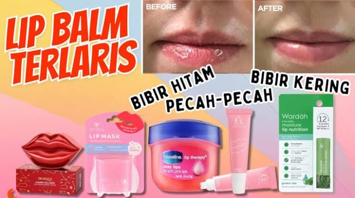 4 Lip Balm SPF Terbaik untuk Bibir Gelap, Cegah Bibir Kehitaman Agar Lembap dan Merah Kembali