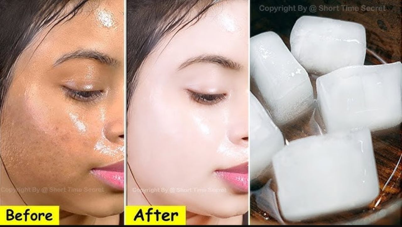 Resep Ice Cube Susu dan Madu untuk Mencerahkan Kulit, 2 Bahan Usir Wajah Kusam