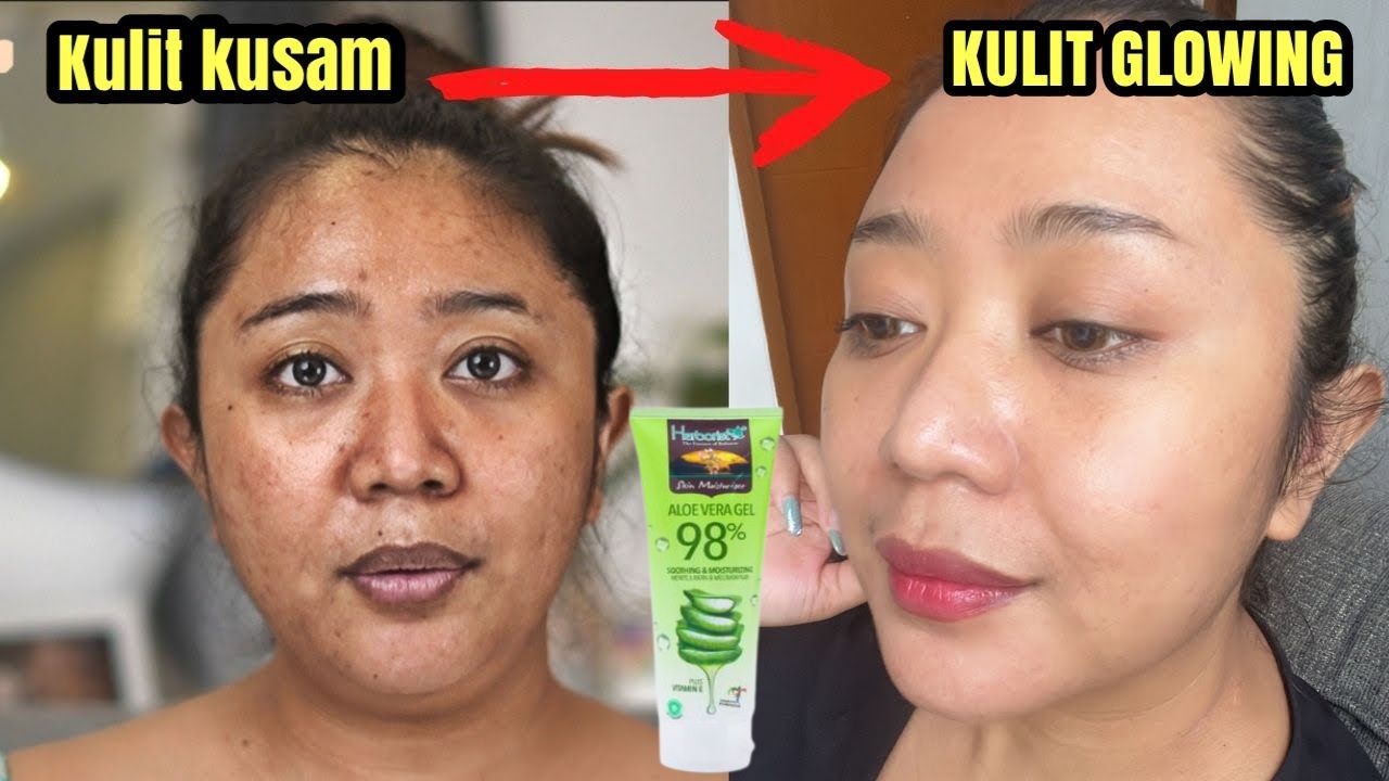 Inilah 3 Produk Gel Lidah Buaya yang Bagus Untuk Menghilangkan Flek Hitam, Bikin Glowing Tanpa Kerutan