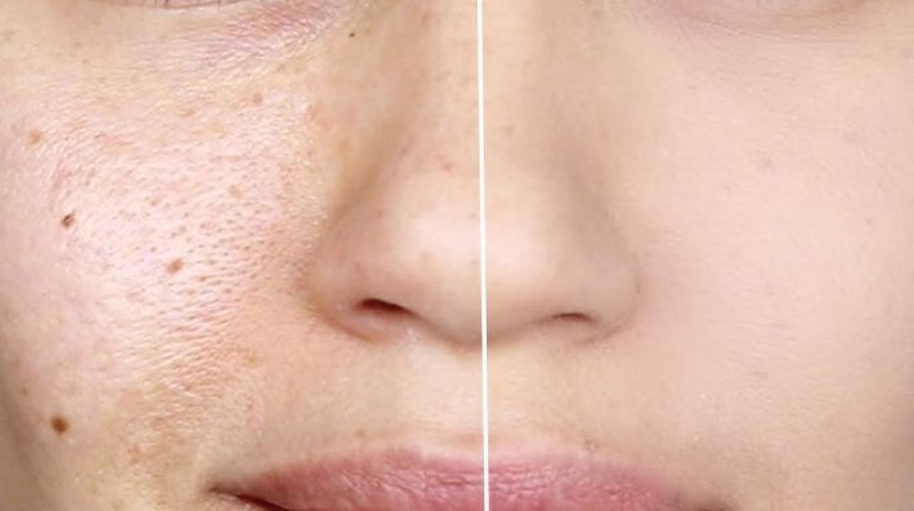 7 Cara Perawatan Agar Wajah Mulus dan Pori-Pori Mengecil, Lakukan Secara Rutin Lihat Hasilnya!