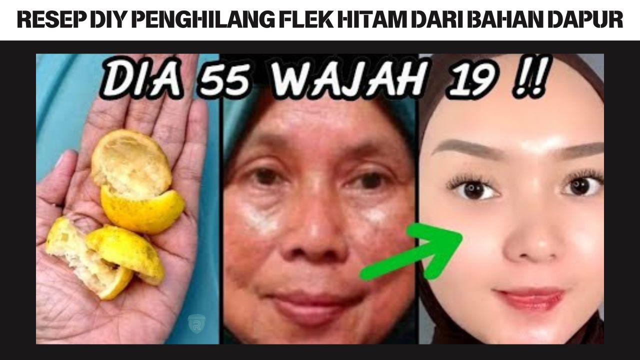 Resep DIY Penghilang Flek Hitam dari Bahan Dapur, Pakai 2 Bahan Ini Bikin Kulit Glowing Tanpa Skincare