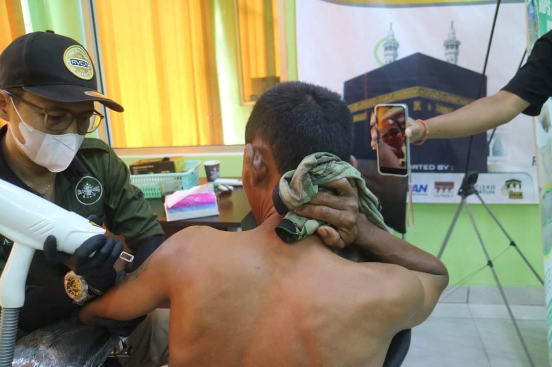 PC GP Ansor Kabupaten Pekalongan Gelar Layanan Hapus Tatto