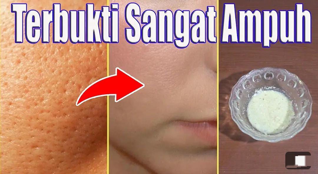 Cara Membuat Racikan Masker Penghalus Pori-Pori, Sekali Oles Kulit Langsung Glowing dan Beba Noda Hitam!