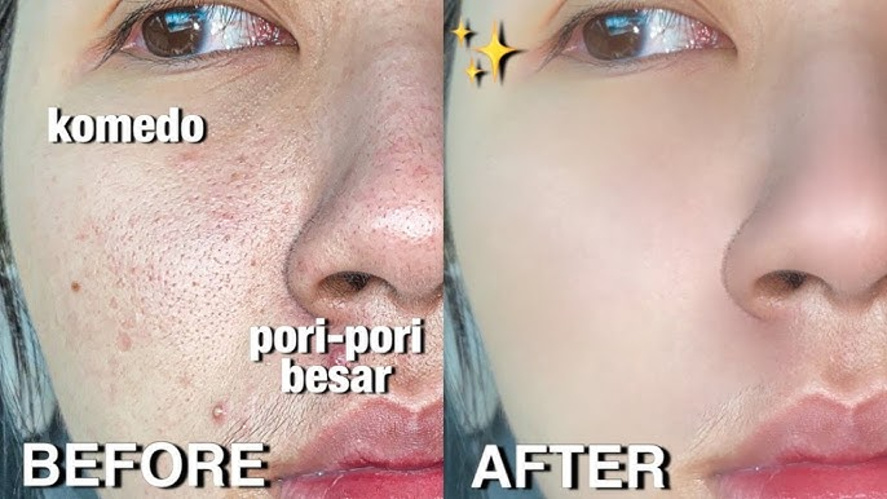 4 Serum Terbaik untuk Kulit Berminyak dan Mengecilkan Pori-Pori, Bikin Wajah Mulus dan Glowing