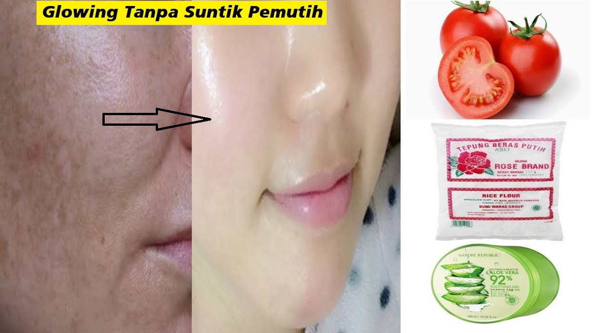 Cara Menghilangkan Flek Hitam yang Membandel di Wajah dengan Masker Tomat dalam 1 Hari, Glowing Tanpa Noda