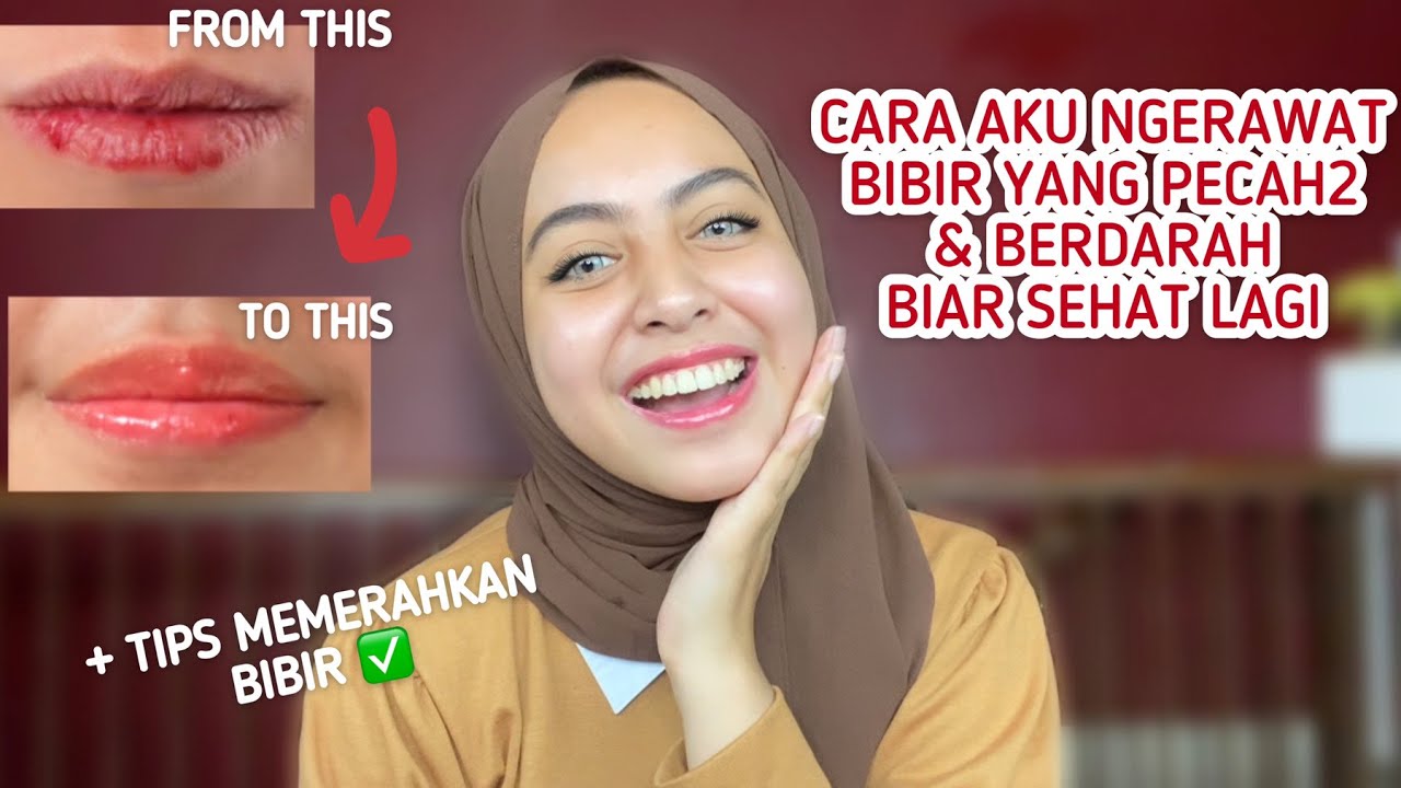5 Cara Memperbaiki Bibir Kering dan Pecah-Pecah Saat Puasa, Bibir Auto Lembap dan Kenyal