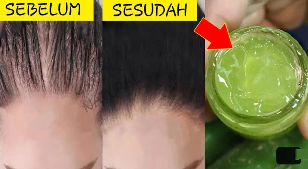 4 Cara Pakai Bahan Dapur untuk Menghilangkan Uban yang Cepat, Bikin Rambut Langsung Hitam Permanen 