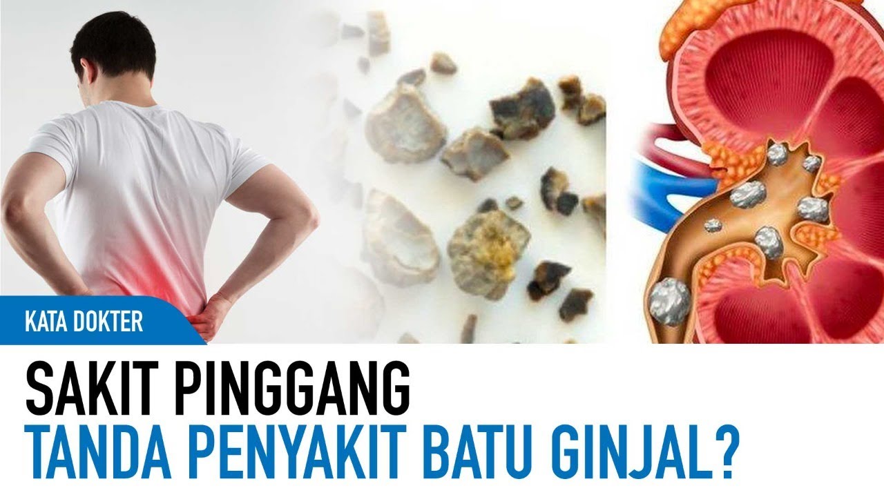 6 Tanda Batu Ginjal yang Harus Kamu Perhatikan sejak Dini, Apa Saja Daftarnya, Cek Selengkapnya Berikut Ini