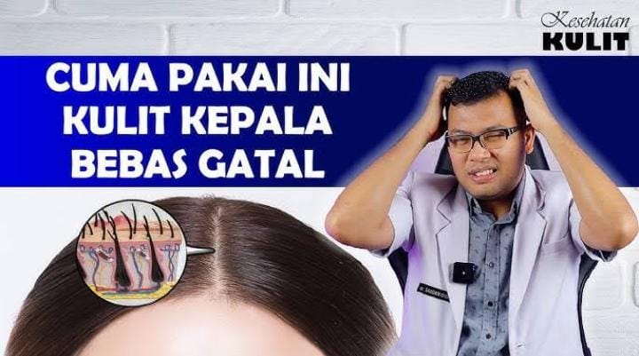 Cara Menghilangkan Gatal Pada Kulit Kepala, Cuma Pakai 1 Bahan Alami Bikin Ketombe Hilang