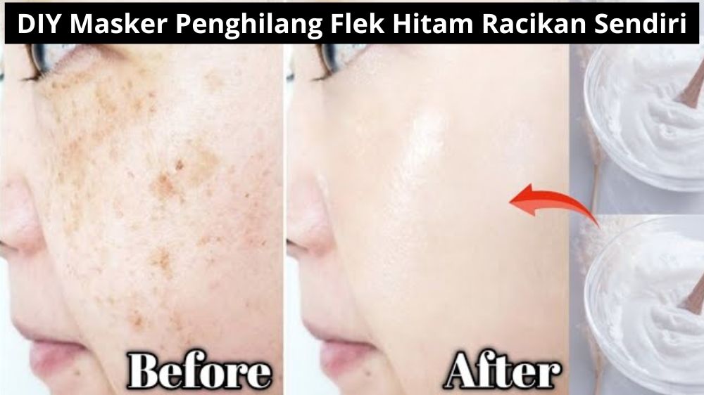 DIY Masker Penghilang Flek Hitam Racikan Sendiri, Cukup 10 Menit Ampuh Memutihkan Bikin Wajah Langsung Glowing