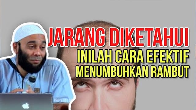 Ini Resep Herbal Atasi Rambut Rontok ala dr Zaidul Akbar, Cukup Pakai 1 Bahan Dapur Efektif Usir Kebotakan