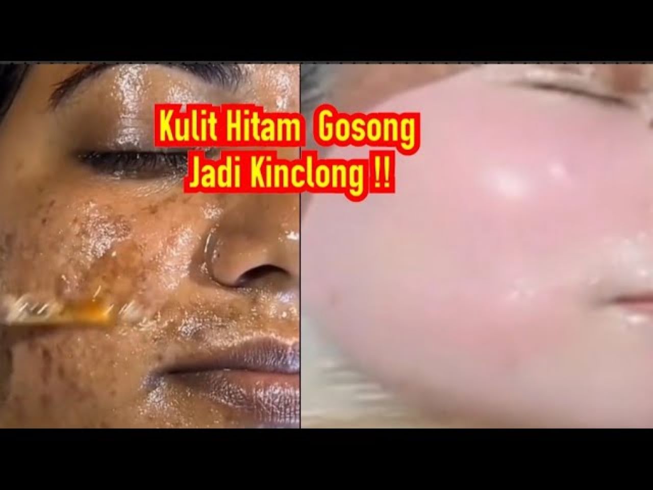 4 Cara Mengelupas Flek Hitam Dengan Masker Susu, Kulit jadi Glowing dan Putih Bebas Penuaan Dini