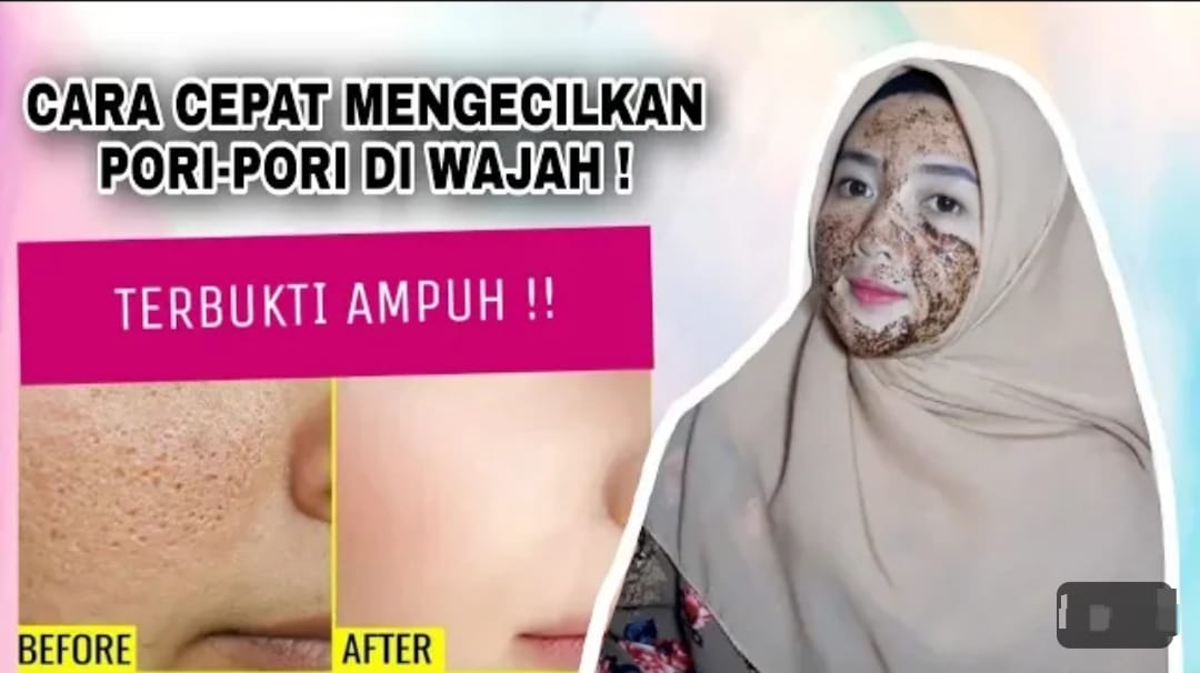 Ternyata, Ini Cara Mengecilkan pori-Pori dalam 3 Hari yang Benar, Kulit jadi Putih Glowing dengan Bahan Alami