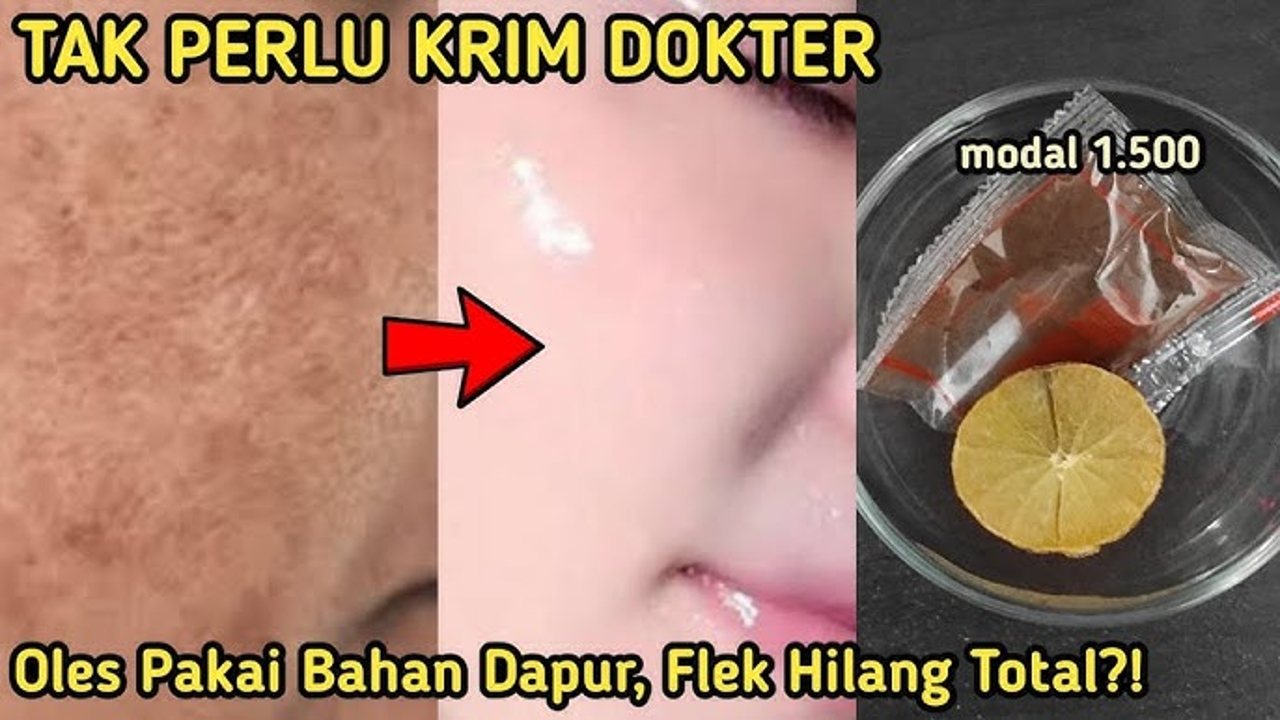 4 Bahan Dapur untuk Mengelupas Flek Hitam dalam 1 Malam, Begini Cara Meraciknya