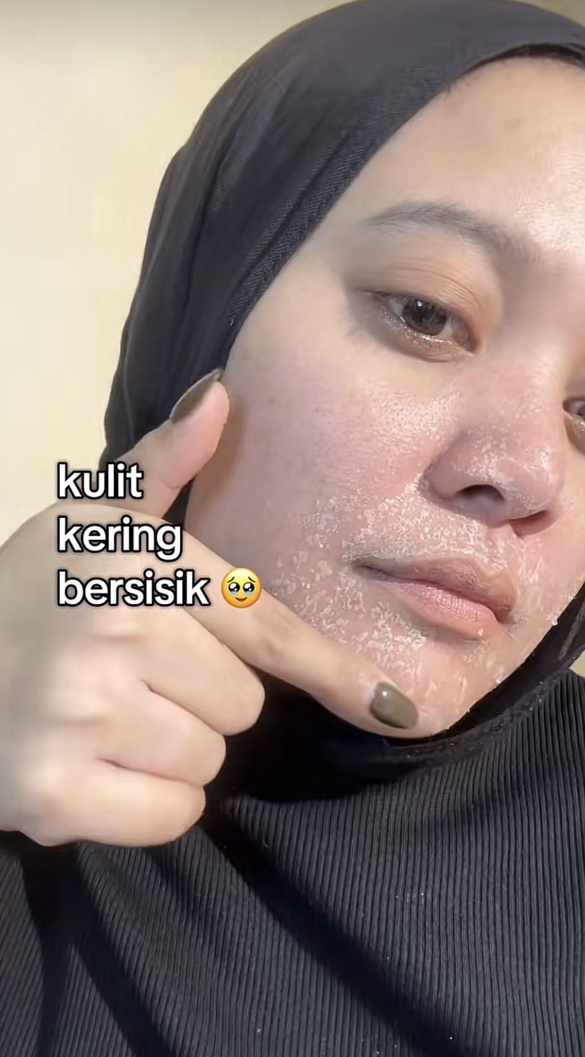 Wajah Kering Saat Puasa Ramadan?Ini 5  Cara Menjaga Kelembapan Kulit Sepanjang Hari