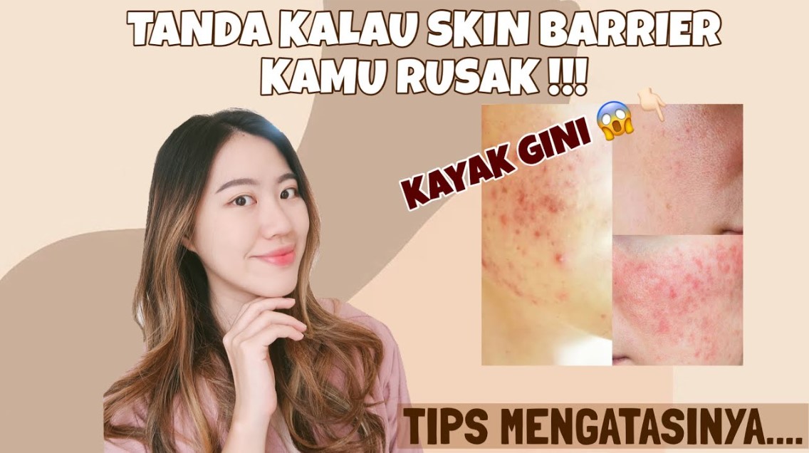 Ternyata, Begini 3 Tanda Skin Barrier Kamu Rusak Sekaligus Tips Mengatasinya