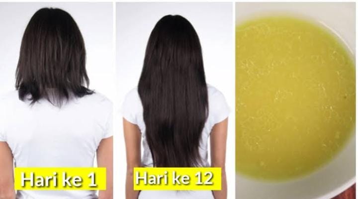 Cara Memanjangkan Rambut Dengan Cepat, Cuma Pakai 1 Jenis Buah Rambut ...