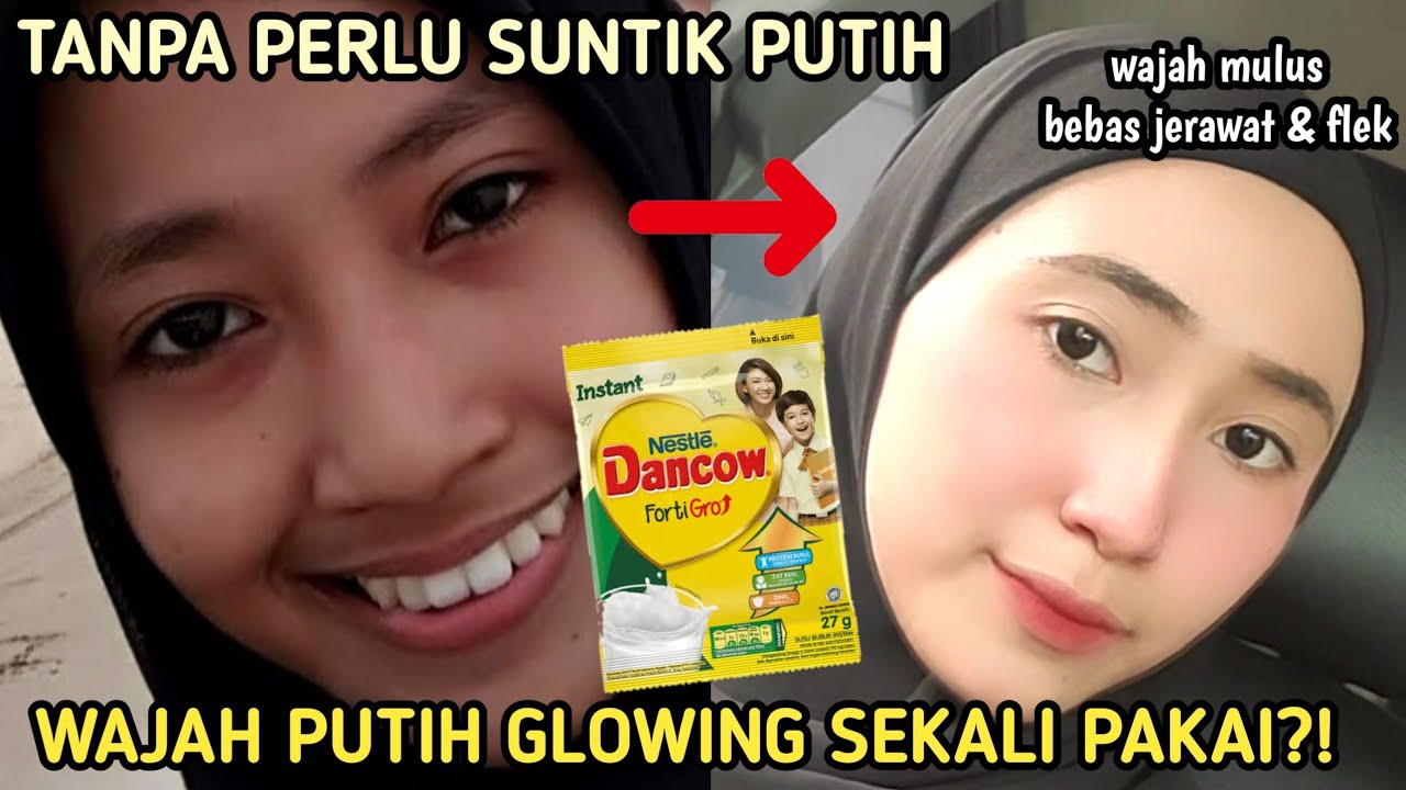 DIY Masker Susu Dancow untuk Mengelupas Flek Hitam Menahun, Bikin Glowing dalam 1 Malam