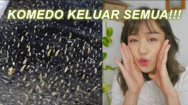 4 Cara Menghilangkan Komedo Hitam Secara Permanen dengan Bahan Alami, Pori-Pori Mengecil Bikin Wajah Mulus