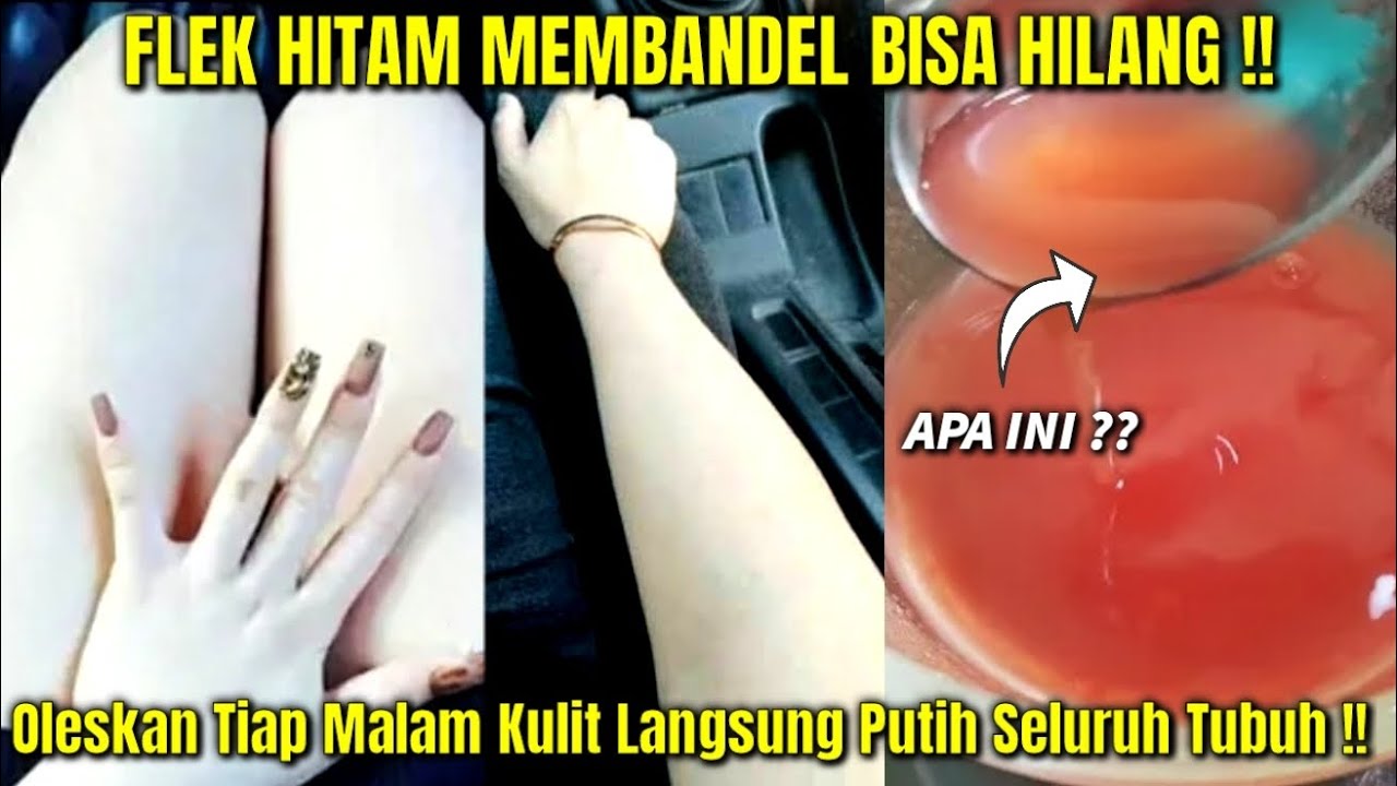 3 Cara Membuat Kolagen Sendiri untuk Wajah Awet Muda, Kulit Kencang Bebas Kerutan dan Kerutan dalam 3 Hari