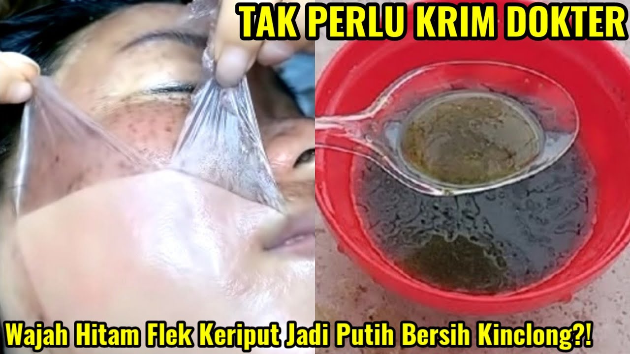 2 Resep Masker Bahan Dapur untuk Memutihkan Wajah dalam 1 Malam, Rahasia Glowing Permanen Bebas Noda Hitam