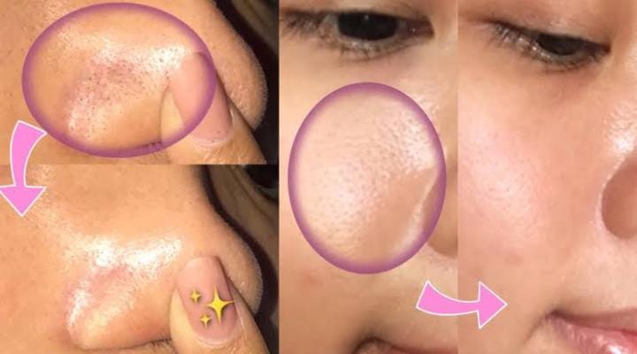 5 Skincare untuk Mengecilkan Pori-Pori Wajah Terbaik 2023, Kulit Mulus Glowing Merata 