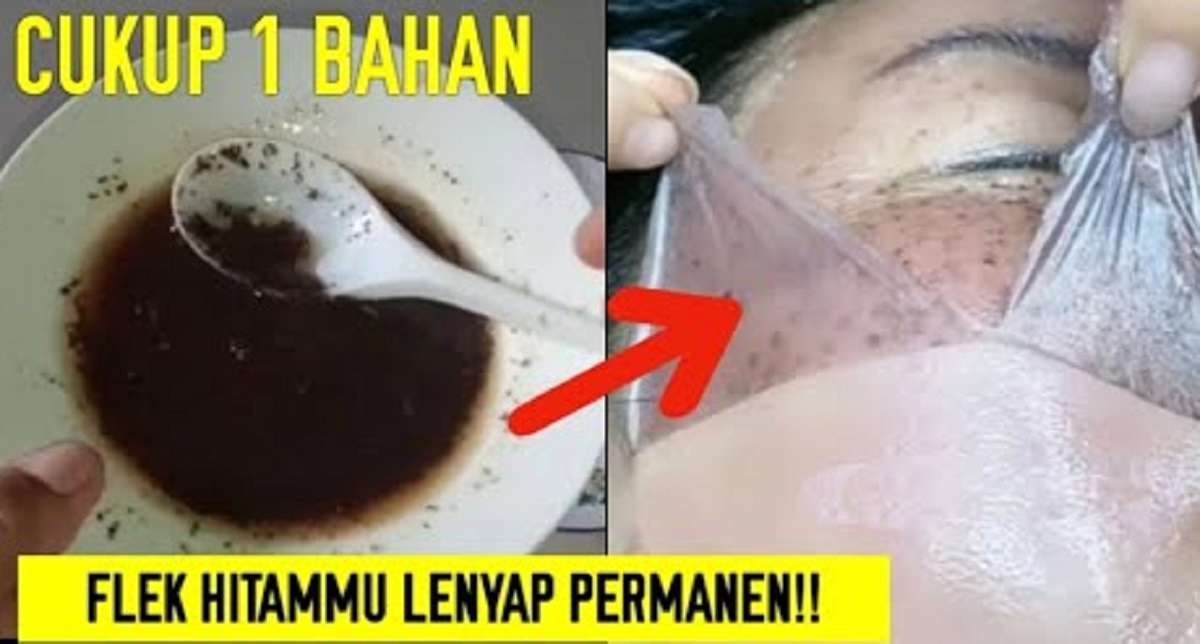 Cara Cepat Memutihkan Flek Hitam Secara Alami, Cuma Perlu 1 Bahan Pemutih Alami