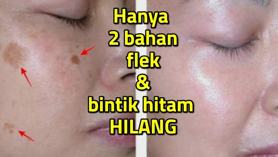 DIY Scrub untuk Flek Hitam, Rahasia Wajah Glowing Cukup Pakai 2 Bahan Dapur Langsung Cerah Merata!