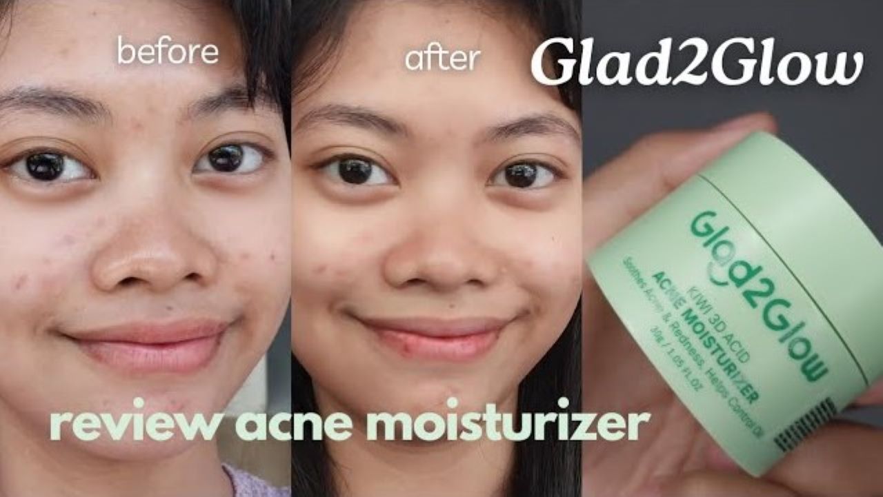 Review Battle Moisturizer Glad2Glow Pink vs Moisturizer Glad2Glow Hijau, Mana yang Terbaik? 