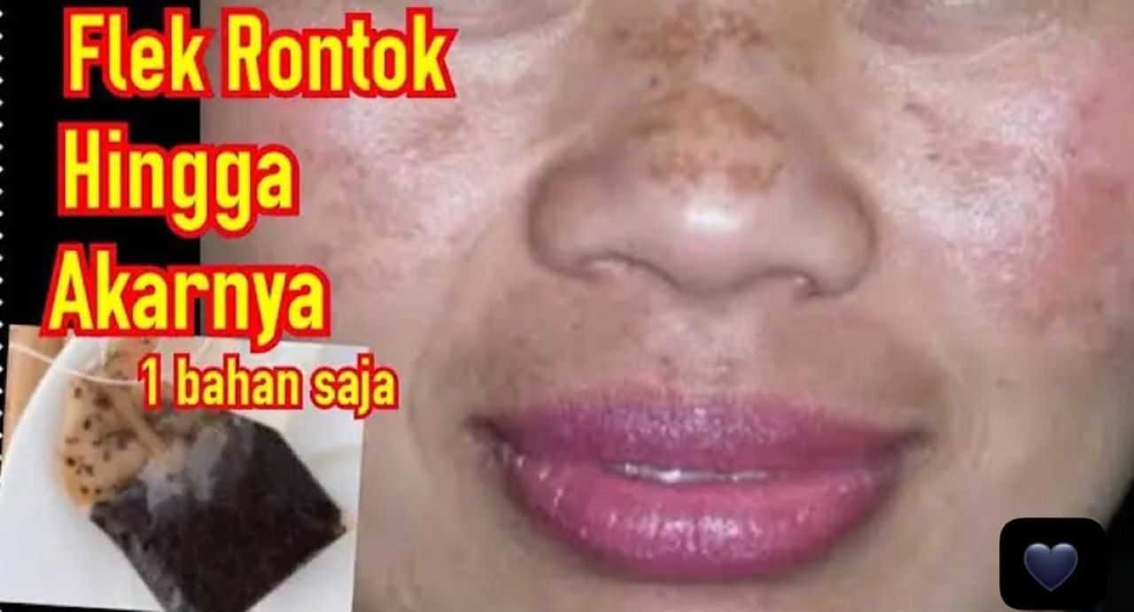 Racikan Teh untuk Mengelupas Flek Hitam, Begini Cara Membuatnya Agar Penuaan Dini