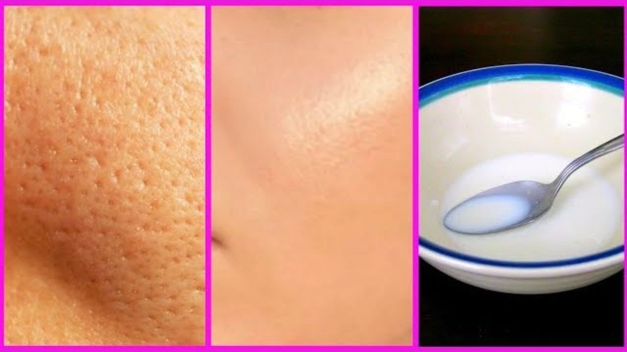 Cara Pakai Susu untuk Mengecilkan Pori-Pori, Tambahkan dengan 1 Jenis Bubuk Ini