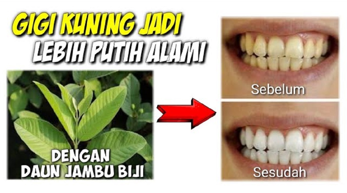 Ternyata, Ini 3 Jenis Daun yang Bisa Memutihkan Gigi Kuning Secara Alami, Ampuh Hilangkan Plak dan Karang Gigi