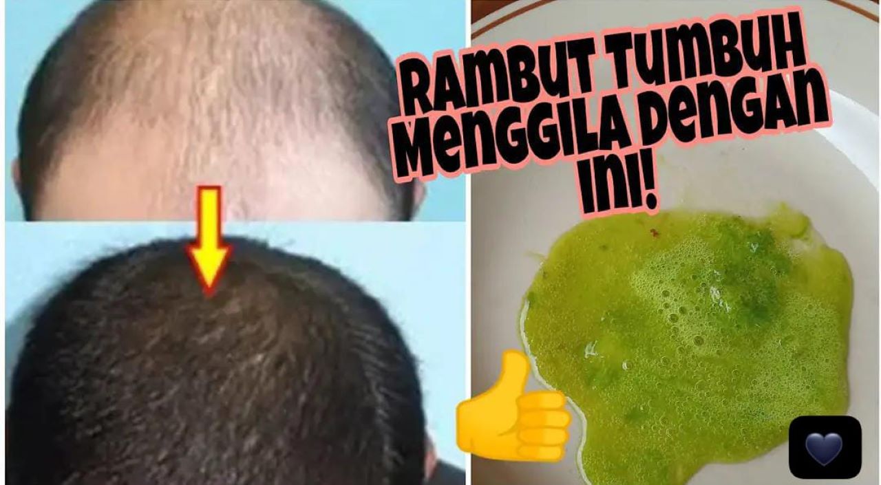 Cara Cepat Menumbuhkan Rambut Pakai Bahan Alami, Bagus untuk Menghilangkan Uban Agar Hitam Permanen