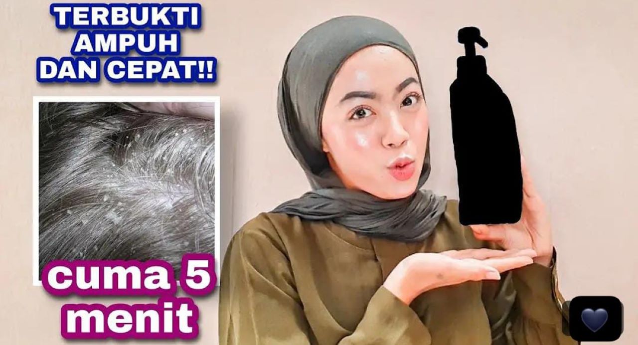 3 Rekomendasi Shampo untuk Kulit Kepala Kering dan Rusak! Cuma 20 Ribu Bikin Rambut Sehat