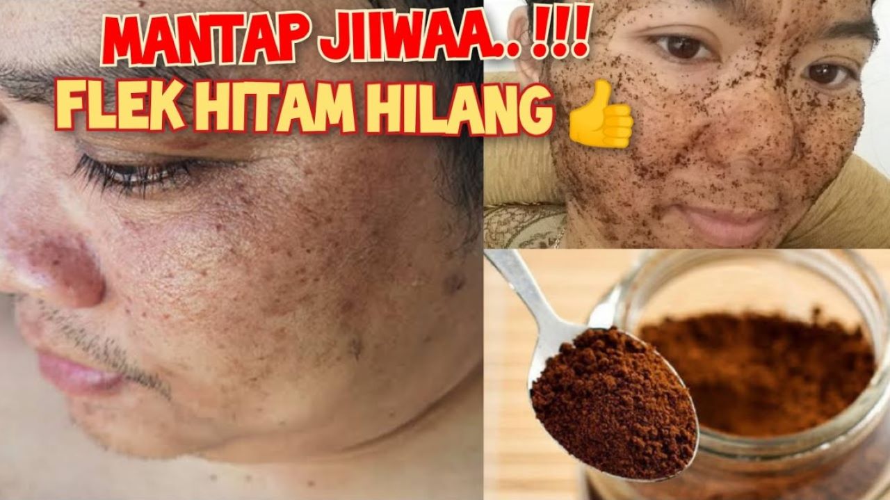 DIY Masker Kopi Pengelupas Flek Hitam dalam 1 Malam, Begini Cara Meraciknya 