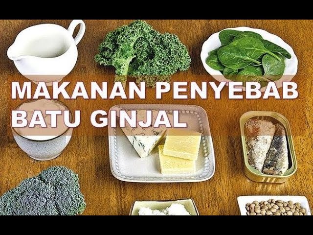 Inilah 6 jenis Makanan Penyebab Batu Ginjal, Termasuk Sarden dan Kentang Goreng yang Harus Kamu Hindari 