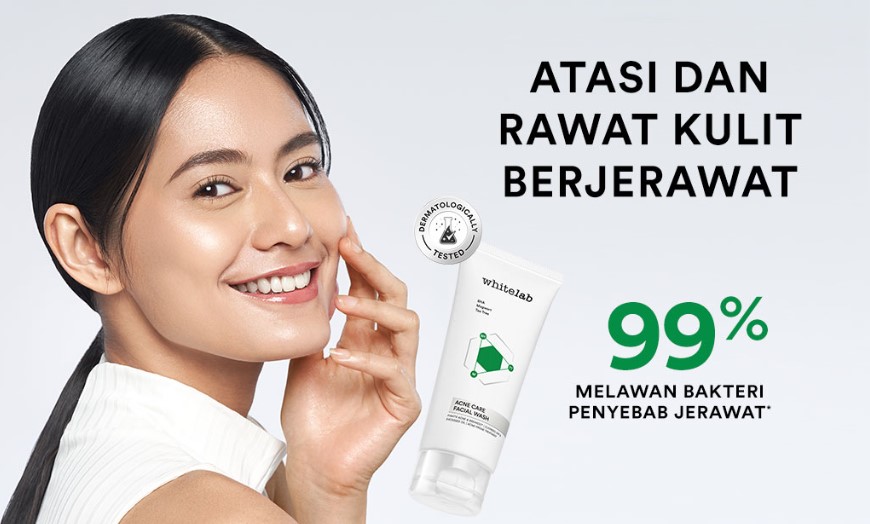 5 Rekomendasi Produk Whitelab untuk Menghilangkan Jerawat, Bikin Mulus sampai Bekasnya!