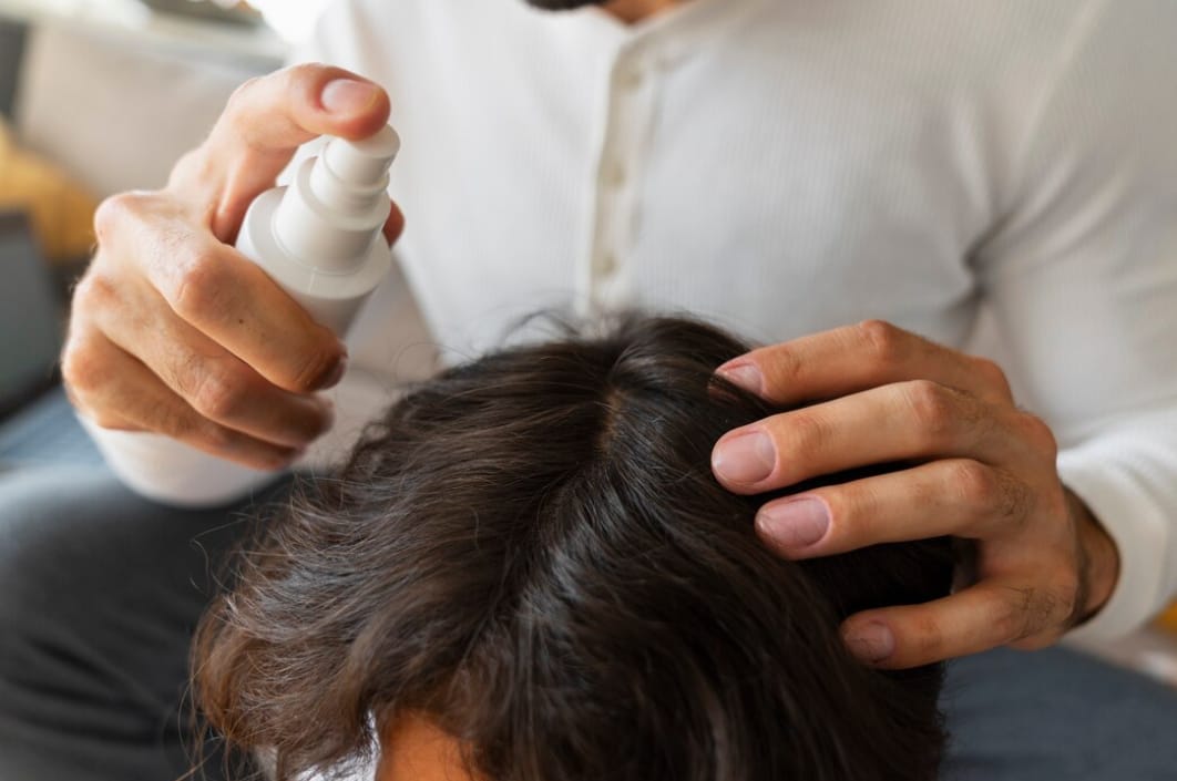 4 Minyak Rambut Penghilang Uban Terbaik, Rambut Putih jadi Hitam Secara Permanen dengan Cepat, Gak Pakai Ribet