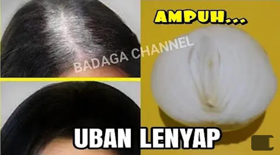 3 Cara Menghitamkan Rambut Uban Secara Permanen Tanpa Ke Salon, Sekali Usap Bikin Rambut Hitam Bebas Uban