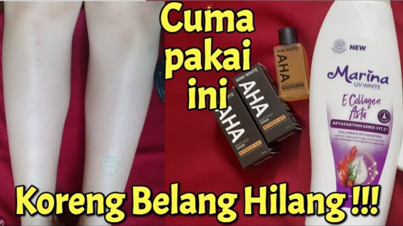 5 Body Lotion yang Ampuh Memutihkan Kulit Belang dan Susah Putih, Tersedia di Alfamart dan Indomaret