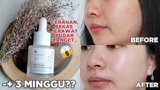 Cara Ampuh Mengecilkan Pori-Pori dan Menghilangkan Bekas Jerawat Hanya dengan Serum Lokal