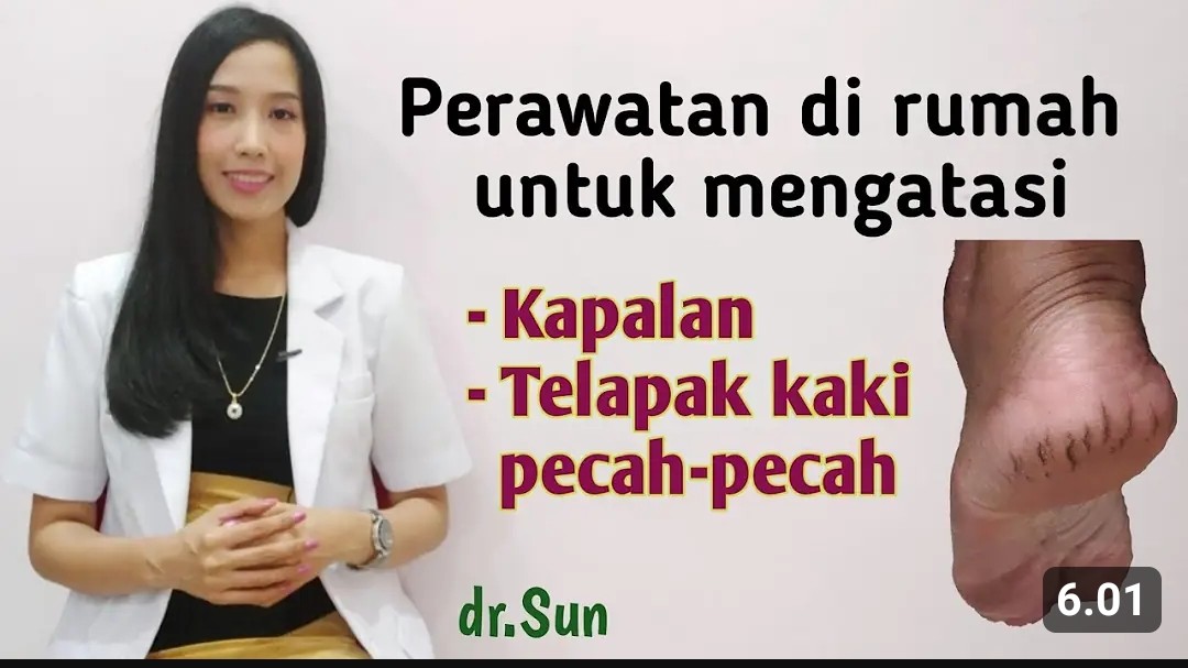 Inilah Sederet Cara Ampuh Hilangkan Pecah-pecah di Kaki Secara Sederhana