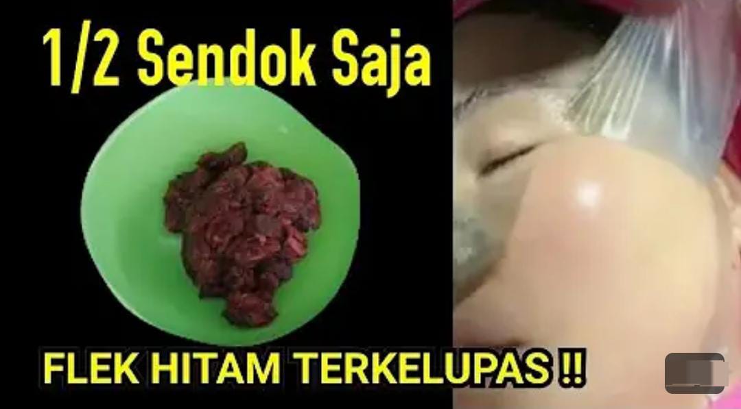 DIY Masker Pengelupas Flek Hitam Dari Bahan Dapur, Kulit Glowing Bebas Kerutan dan Noda Hitam Dalam 1 Malam