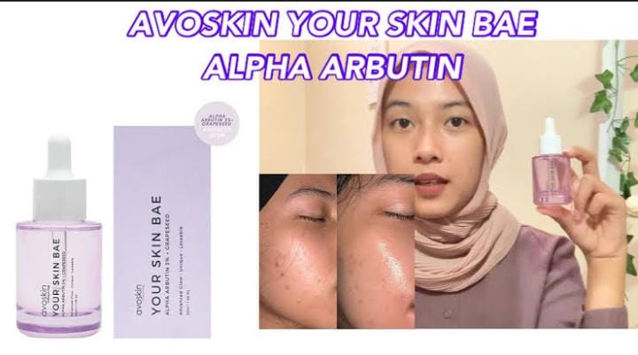 5 Skincare yang Cepat Menghilangkan Flek Hitam, Hasilnya Kulit Auto Glowing dan Awet Muda Sepanjang Masa