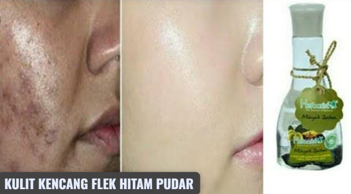 Begini Cara Pakai Minyak Zaitun Agar Wajah Kencang dan Glowing, Bebas Flek Hitam dalam 4 Langkah