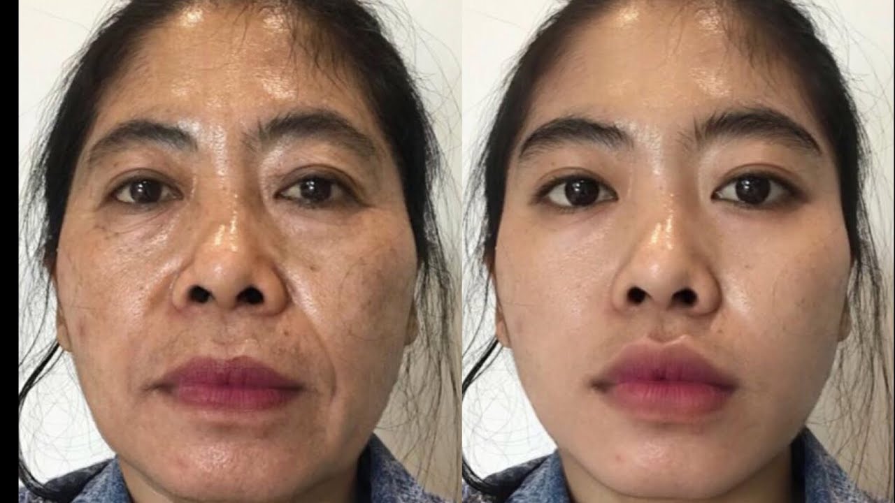 TERBUKTI! 3 Cara Mengembalikan Wajah yang Terlihat Tua Agar Muda Tanpa Operasi Plastik 