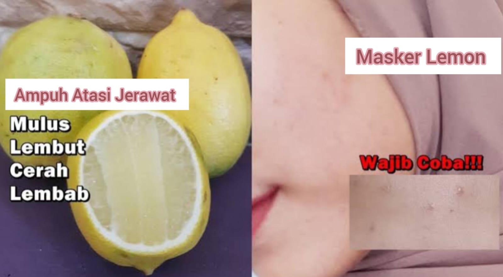 3 Langkah Membuat Masker Lemon Ampuh Atasi Masalah Jerawat, Noda Bekas Jerawat di Wajah Bisa Hilang Permanen!